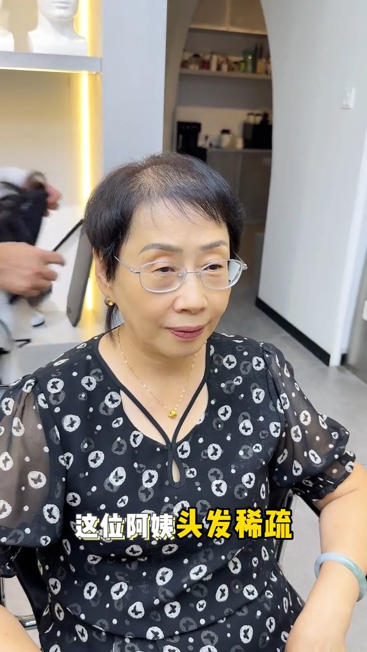 头顶补发神器，立竿见影的补发片